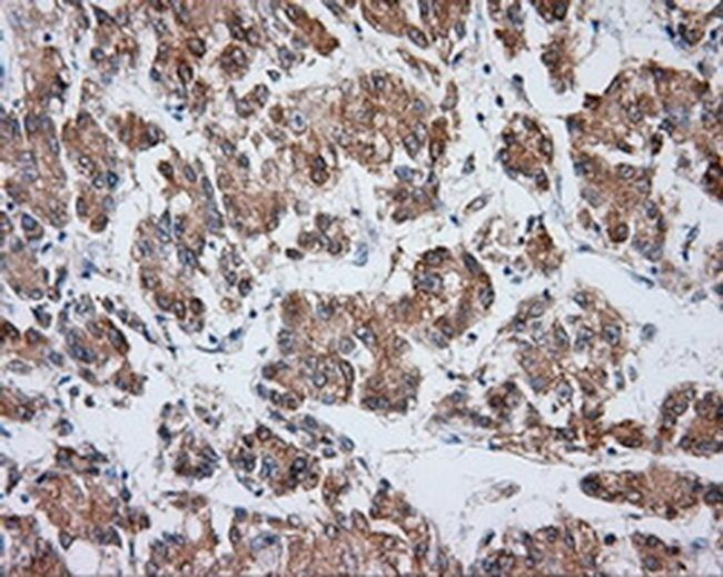 VAT1L Antibody in Immunohistochemistry (Paraffin) (IHC (P))