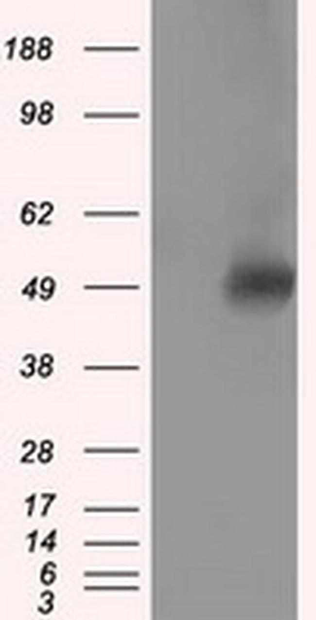 VAT1L Antibody in Western Blot (WB)