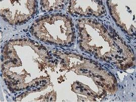 TACC3 Antibody in Immunohistochemistry (Paraffin) (IHC (P))