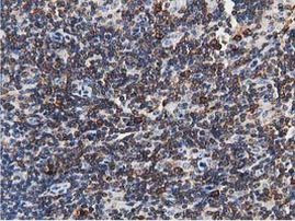 TACC3 Antibody in Immunohistochemistry (Paraffin) (IHC (P))