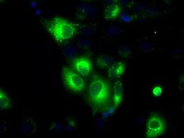 H6PD Antibody in Immunocytochemistry (ICC/IF)