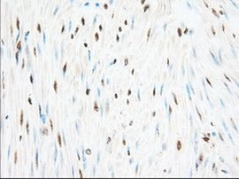 H6PD Antibody in Immunohistochemistry (Paraffin) (IHC (P))