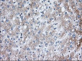 H6PD Antibody in Immunohistochemistry (Paraffin) (IHC (P))