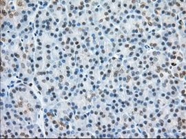 H6PD Antibody in Immunohistochemistry (Paraffin) (IHC (P))