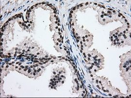 H6PD Antibody in Immunohistochemistry (Paraffin) (IHC (P))