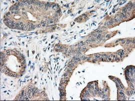 NXNL2 Antibody in Immunohistochemistry (Paraffin) (IHC (P))