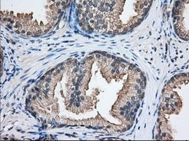 NXNL2 Antibody in Immunohistochemistry (Paraffin) (IHC (P))