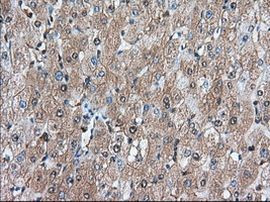 BDH2 Antibody in Immunohistochemistry (Paraffin) (IHC (P))