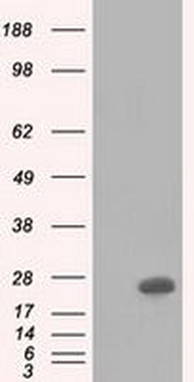 BDH2 Antibody in Western Blot (WB)