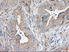 SNX9 Antibody in Immunohistochemistry (Paraffin) (IHC (P))