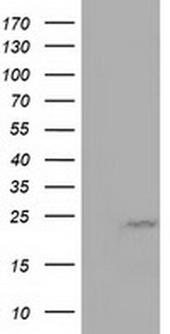 MOB4A Antibody in Western Blot (WB)