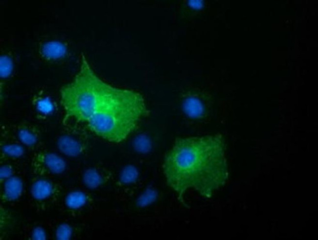 SH3GL1 Antibody in Immunocytochemistry (ICC/IF)