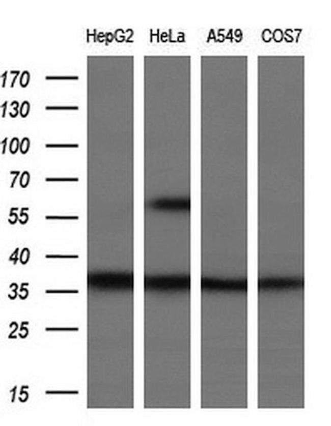 UCK1 Antibody in Western Blot (WB)