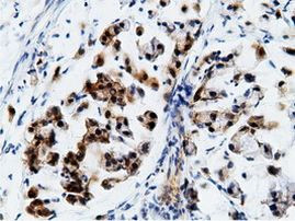 EPHX2 Antibody in Immunohistochemistry (Paraffin) (IHC (P))