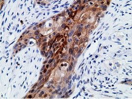 EPHX2 Antibody in Immunohistochemistry (Paraffin) (IHC (P))