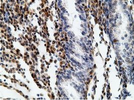 EPHX2 Antibody in Immunohistochemistry (Paraffin) (IHC (P))