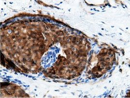 EPHX2 Antibody in Immunohistochemistry (Paraffin) (IHC (P))