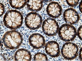 EPHX2 Antibody in Immunohistochemistry (Paraffin) (IHC (P))