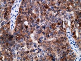 EPHX2 Antibody in Immunohistochemistry (Paraffin) (IHC (P))