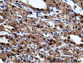 EPHX2 Antibody in Immunohistochemistry (Paraffin) (IHC (P))