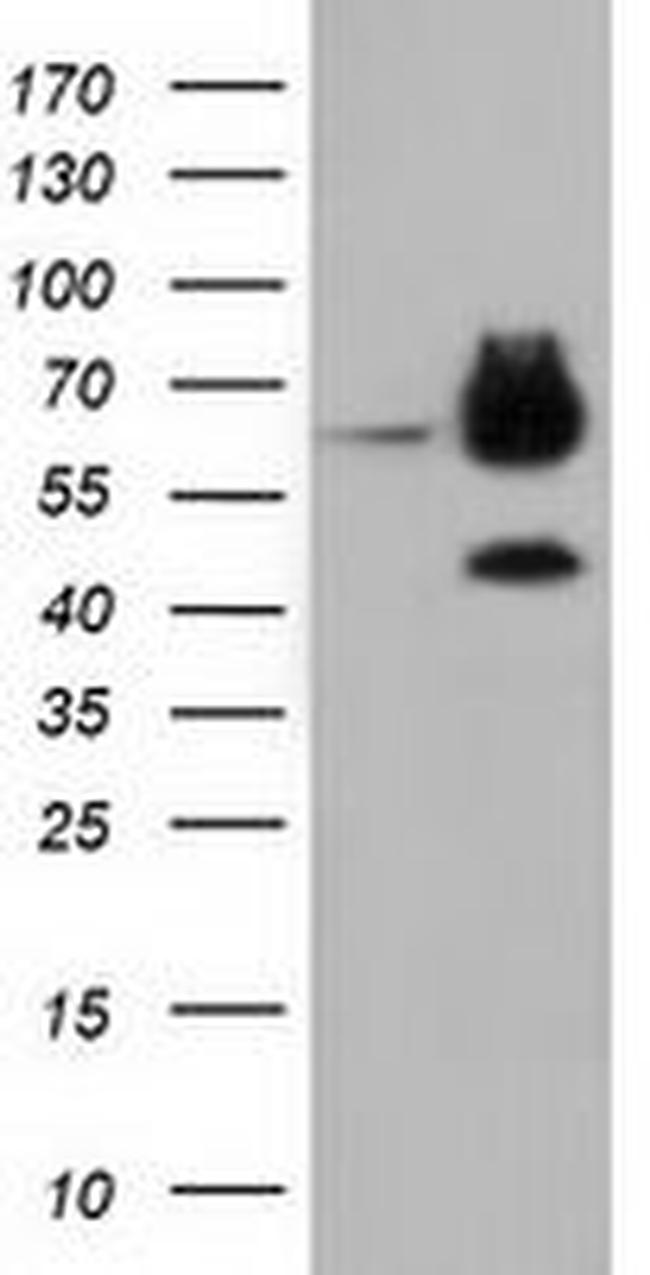 EPHX2 Antibody in Western Blot (WB)