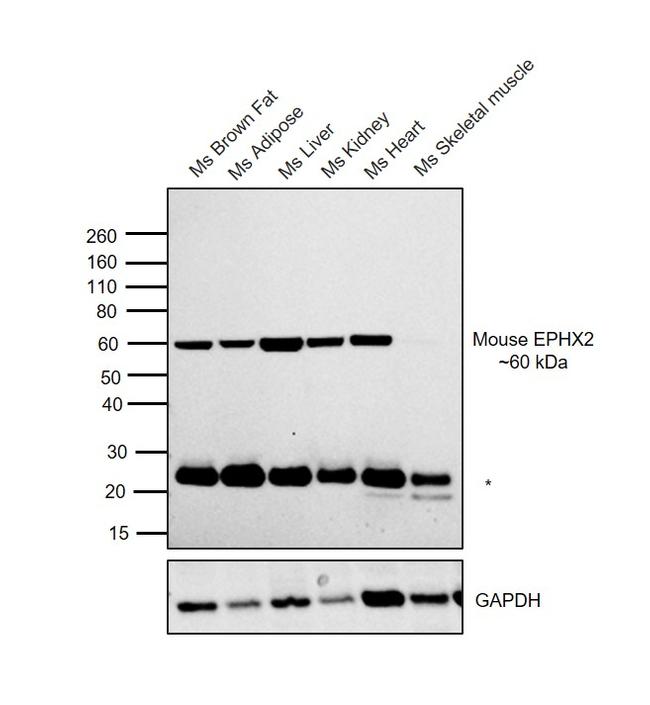 EPHX2 Antibody in Western Blot (WB)