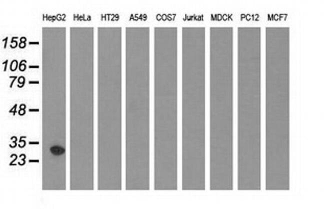 SULT2A1 Antibody in Western Blot (WB)