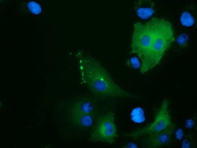 ARHGAP25 Antibody in Immunocytochemistry (ICC/IF)