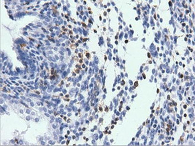 ARHGAP25 Antibody in Immunohistochemistry (Paraffin) (IHC (P))