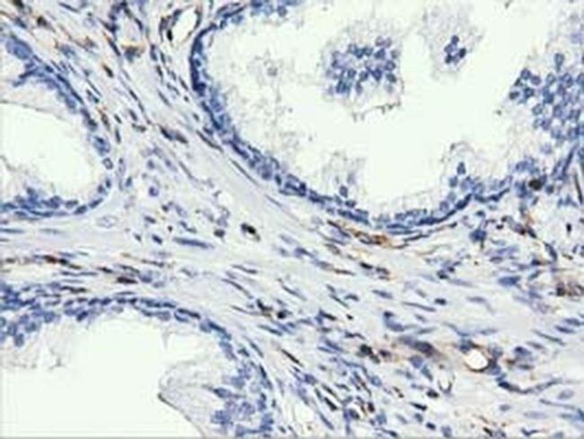 ARHGAP25 Antibody in Immunohistochemistry (Paraffin) (IHC (P))