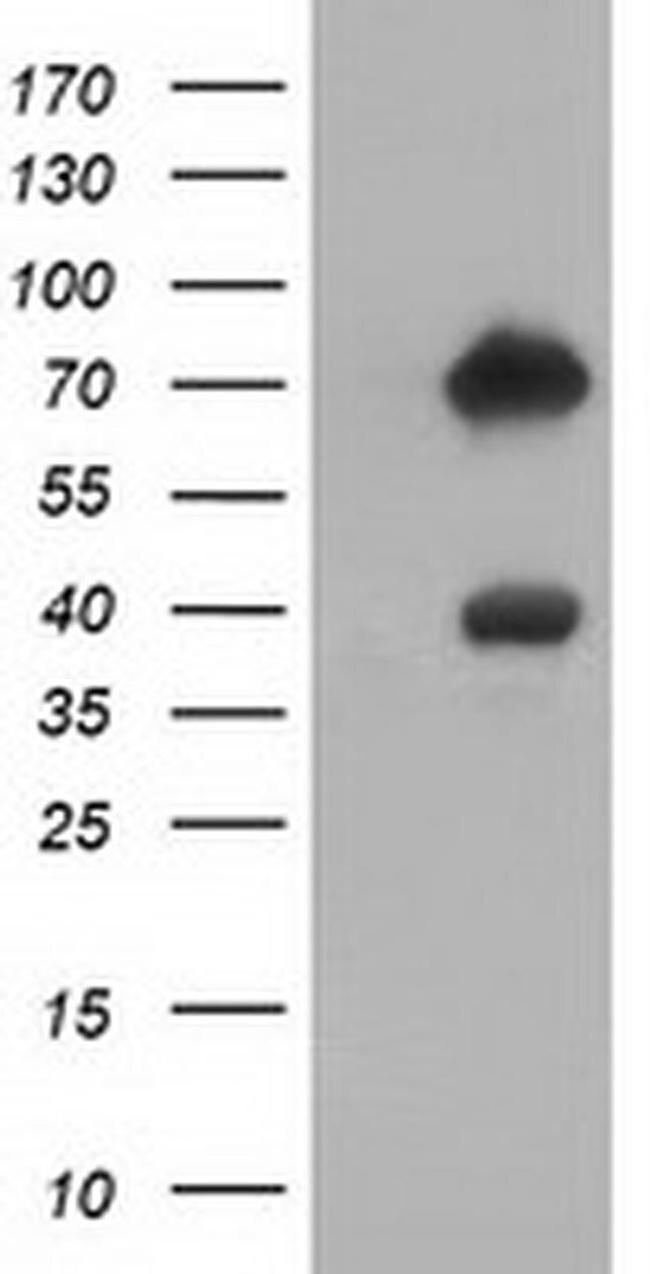 ARHGAP25 Antibody in Western Blot (WB)