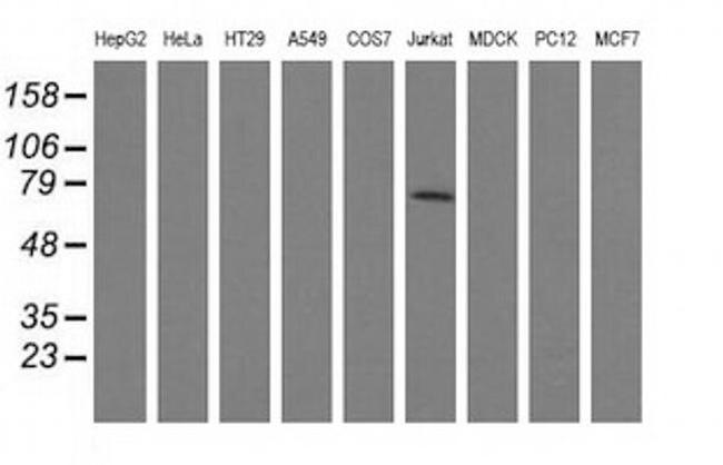 ARHGAP25 Antibody in Western Blot (WB)