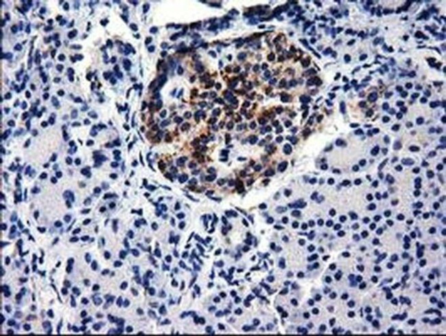 GGPS1 Antibody in Immunohistochemistry (Paraffin) (IHC (P))