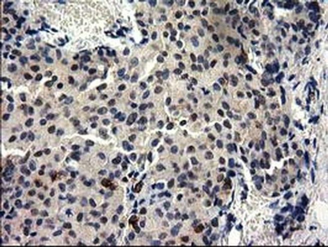 GGPS1 Antibody in Immunohistochemistry (Paraffin) (IHC (P))