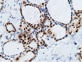 EPM2AIP1 Antibody in Immunohistochemistry (Paraffin) (IHC (P))