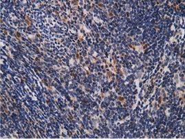 EPM2AIP1 Antibody in Immunohistochemistry (Paraffin) (IHC (P))