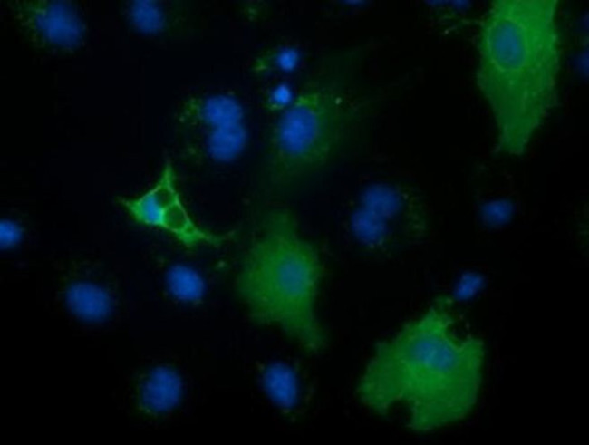 PECR Antibody in Immunocytochemistry (ICC/IF)