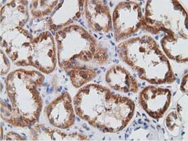 PECR Antibody in Immunohistochemistry (Paraffin) (IHC (P))