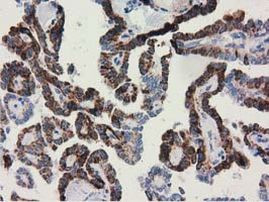 Adenylate Kinase 3 Antibody in Immunohistochemistry (Paraffin) (IHC (P))