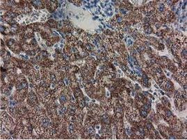 Adenylate Kinase 3 Antibody in Immunohistochemistry (Paraffin) (IHC (P))