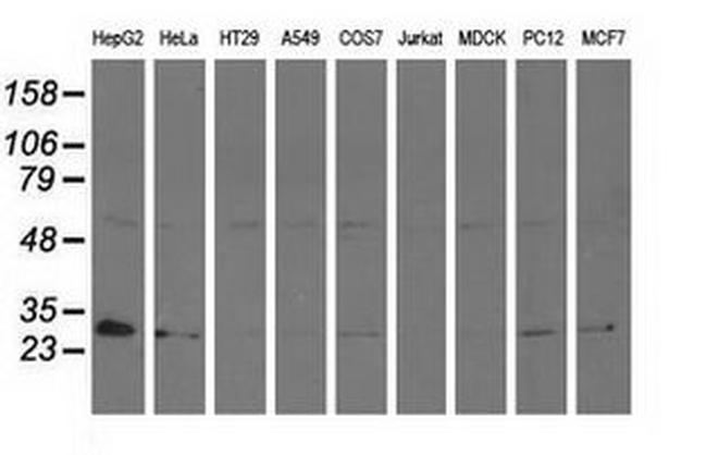 Adenylate Kinase 3 Antibody in Western Blot (WB)