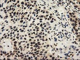 SULT1A1 Antibody in Immunohistochemistry (Paraffin) (IHC (P))