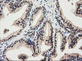 RNH1 Antibody in Immunohistochemistry (Paraffin) (IHC (P))