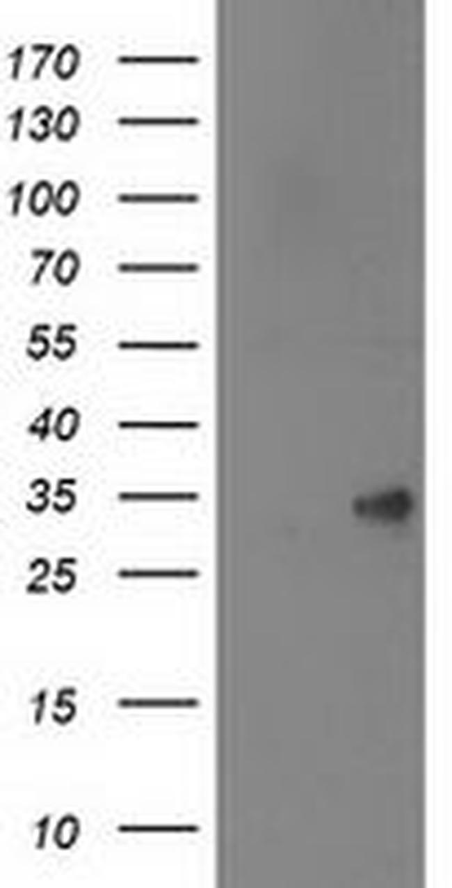 SPR Antibody in Western Blot (WB)