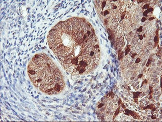 RABL2A Antibody in Immunohistochemistry (Paraffin) (IHC (P))