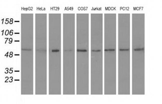 Syntrophin alpha-1 Antibody in Western Blot (WB)