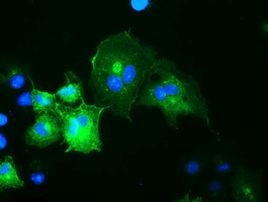 OSBPL11 Antibody in Immunocytochemistry (ICC/IF)