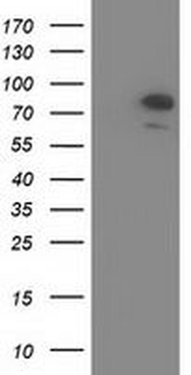 OSBPL11 Antibody in Western Blot (WB)