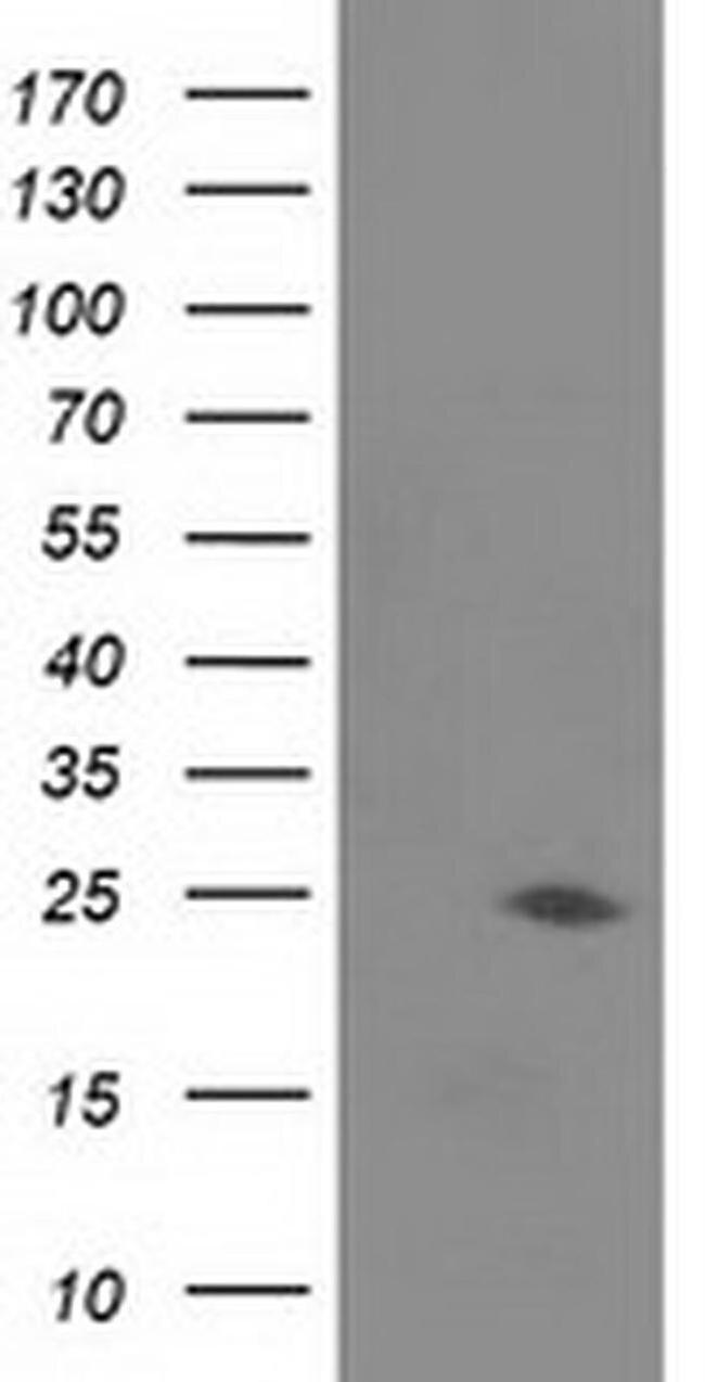 JOSD1 Antibody in Western Blot (WB)