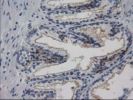 PACSIN3 Antibody in Immunohistochemistry (Paraffin) (IHC (P))